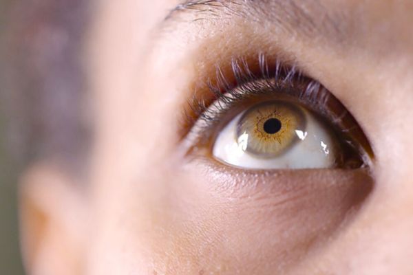 Entendendo o descolamento de retina